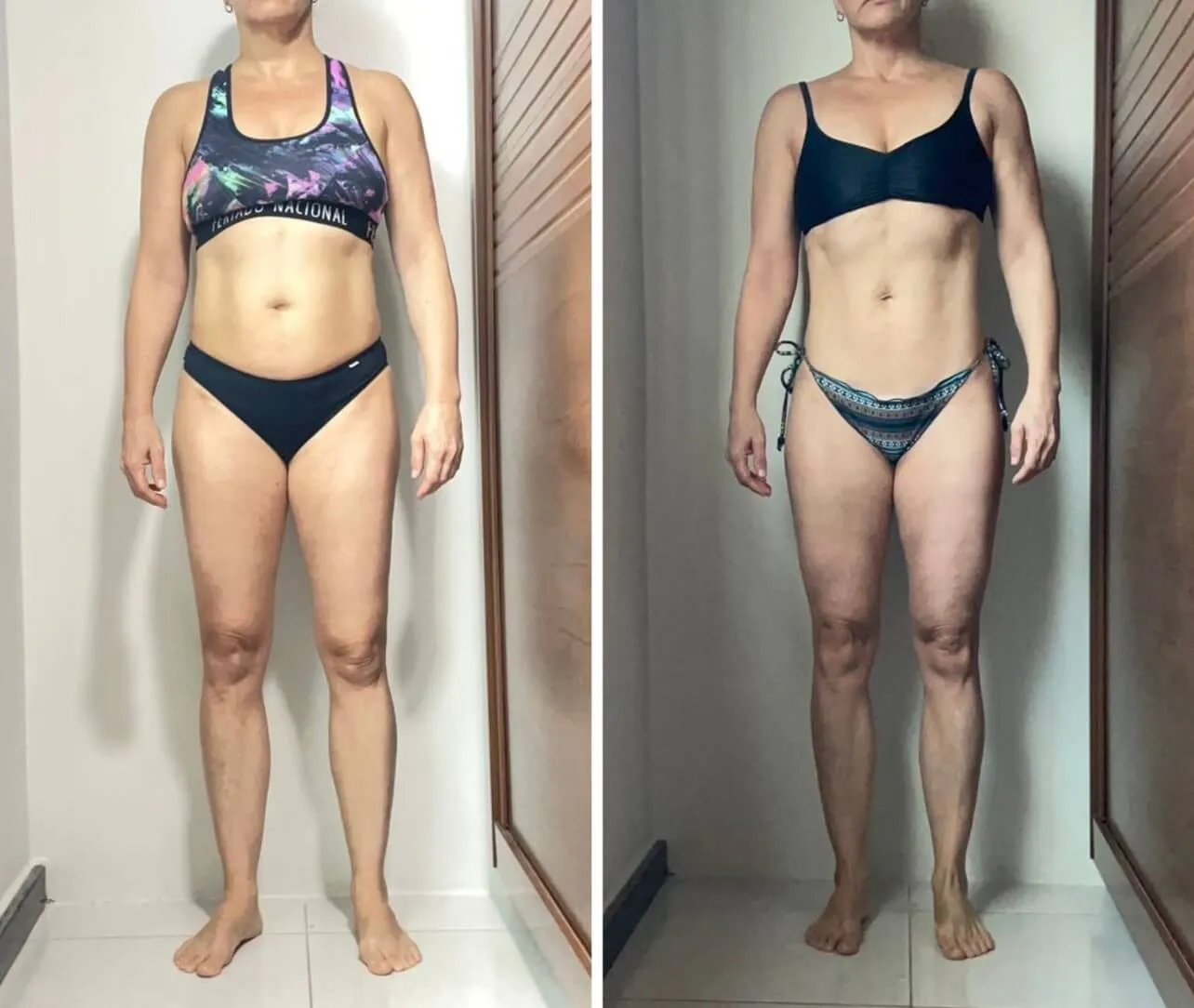 Antes e depois 4